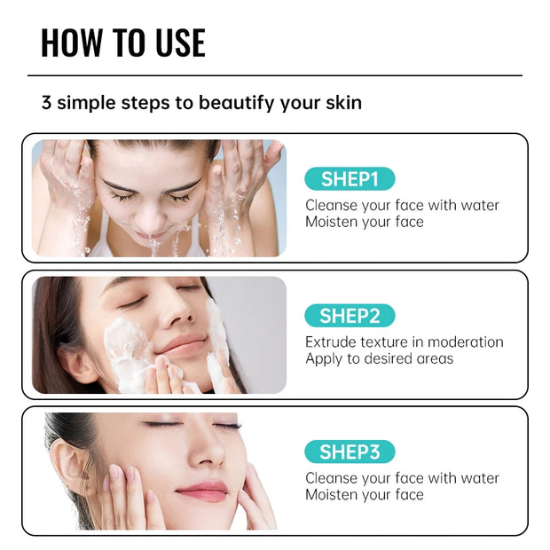 Acne Repair Face Cream